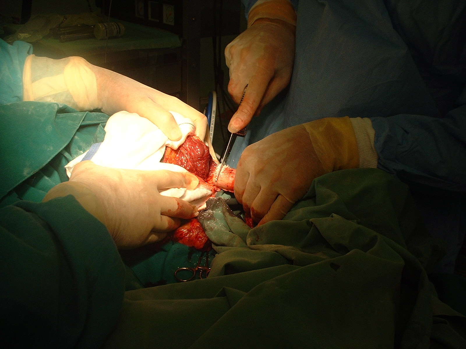 Operative photograph — closure
