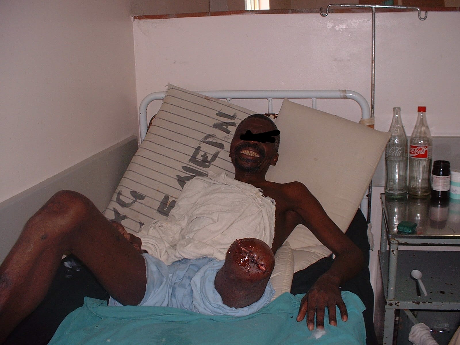 Tata post-operative — smiling